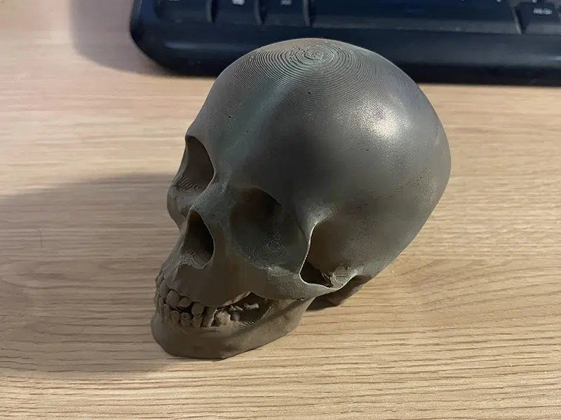 3D printed bronze skull